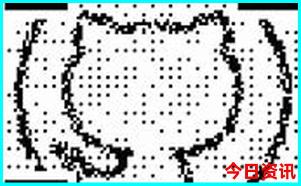 3d定位精准100%免费预测